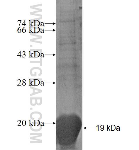 PRDM5 fusion protein Ag5376 SDS-PAGE PRDM5 fusion protein Ag5376 SDS-PAGE