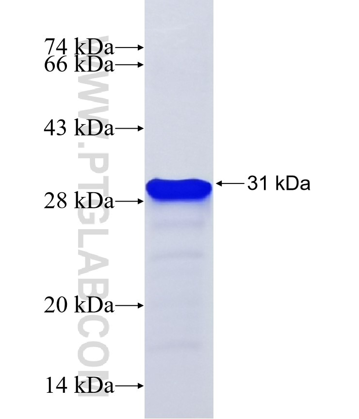 PRDM6 fusion protein Ag38041 SDS-PAGE PRDM6 fusion protein Ag38041 SDS-PAGE