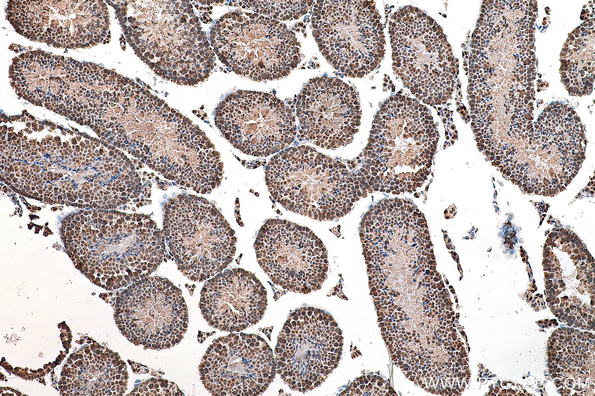 Immunohistochemistry (IHC) staining of mouse testis tissue using PRDM7 Polyclonal antibody (22078-1-AP)