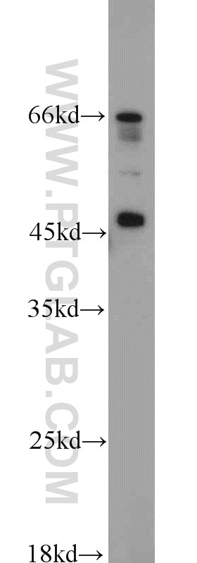 Western Blot (WB) analysis of HeLa cells using PRDM7 Polyclonal antibody (22078-1-AP)