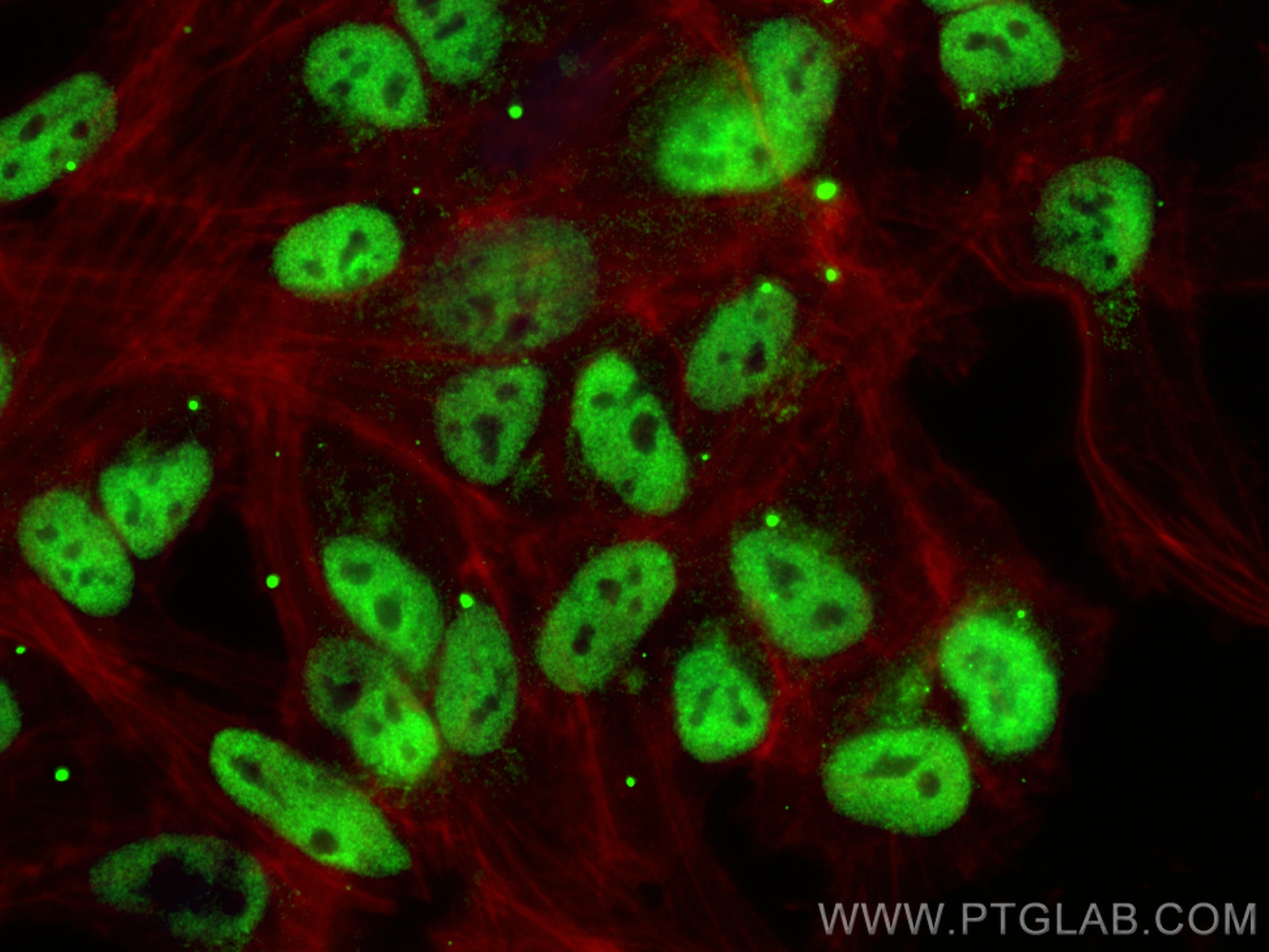 Immunofluorescence (IF) / fluorescent staining of hTERT-RPE1 cells using PRDM8 Polyclonal antibody (26010-1-AP)