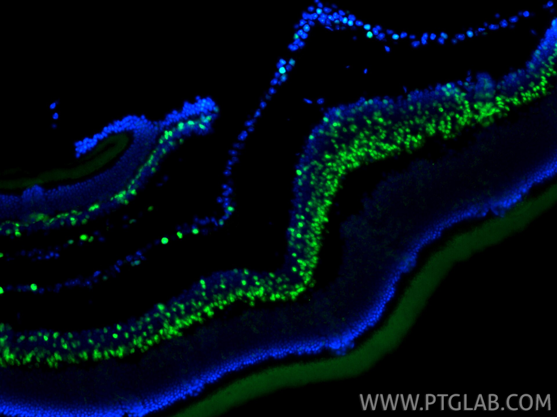 IF Staining of mouse eye using 84716-2-RR (same clone as 84716-2-PBS) Immunofluorescence (IF) / fluorescent staining of mouse eye tissue using PRDM8 Recombinant monoclonal antibody (84716-2-RR)