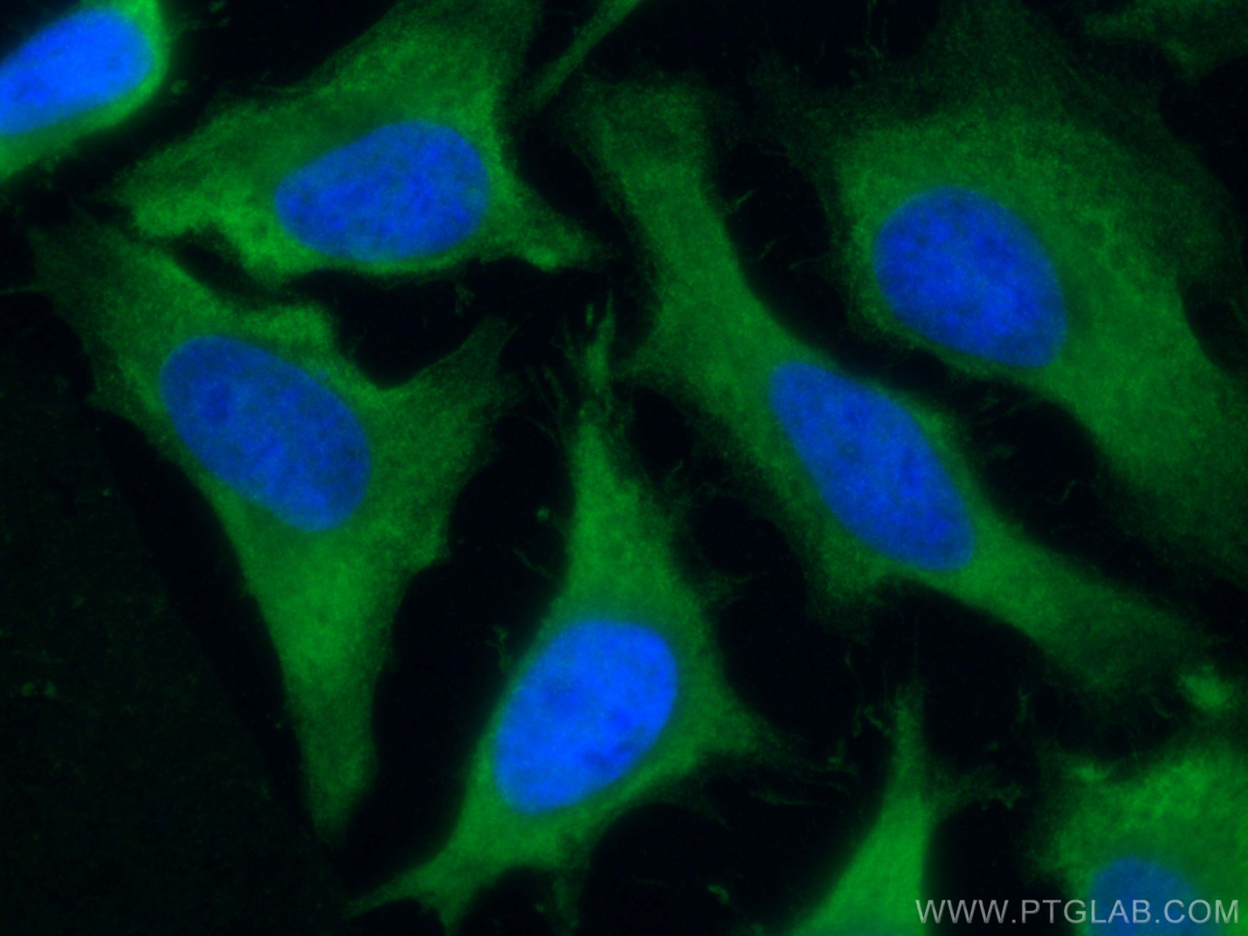 Immunofluorescence (IF) / fluorescent staining of HeLa cells using PRDX1 Polyclonal antibody (15816-1-AP)