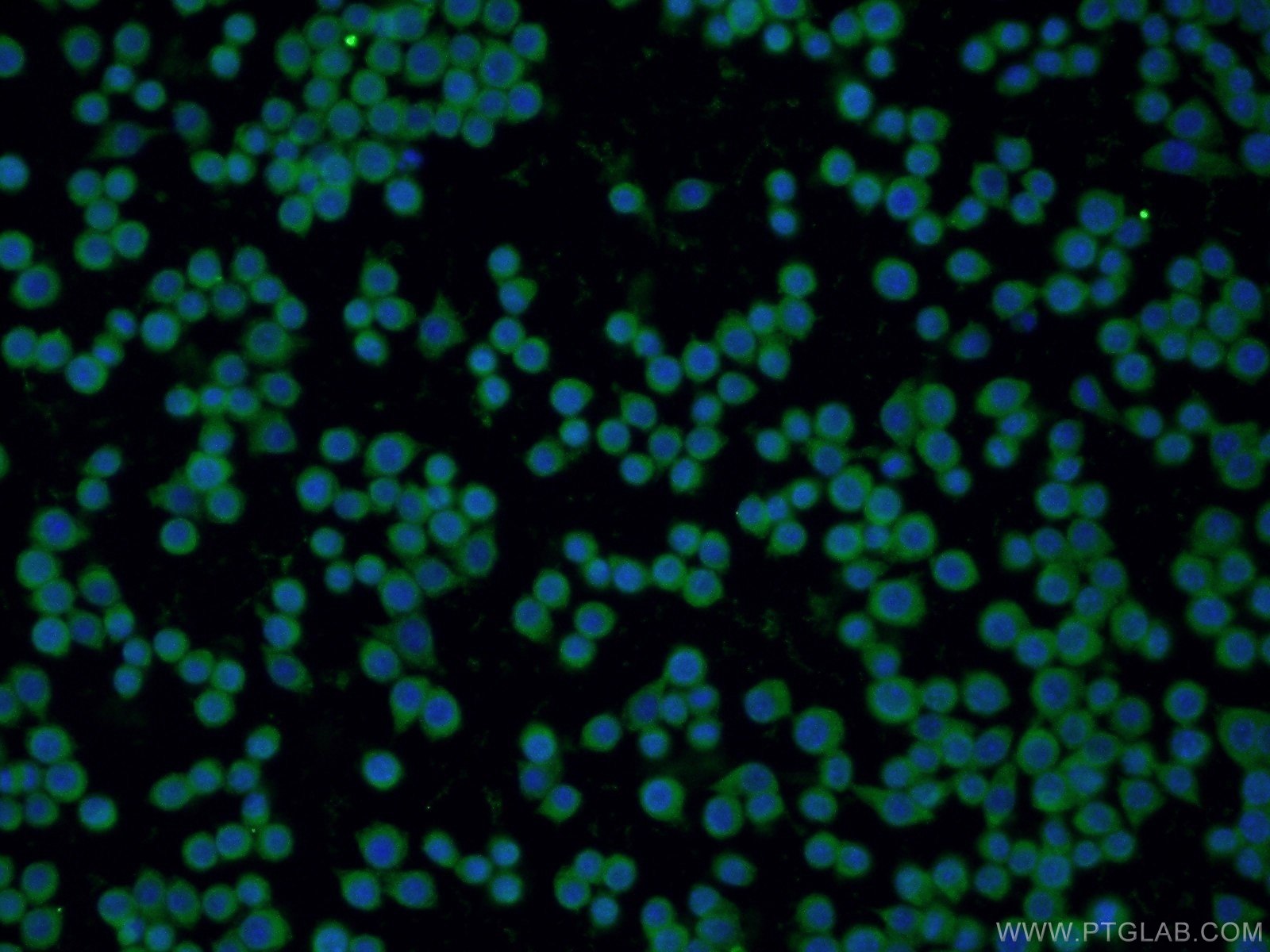 Immunofluorescence (IF) / fluorescent staining of RAW 264.7 cells using PRDX1 Polyclonal antibody (15816-1-AP)