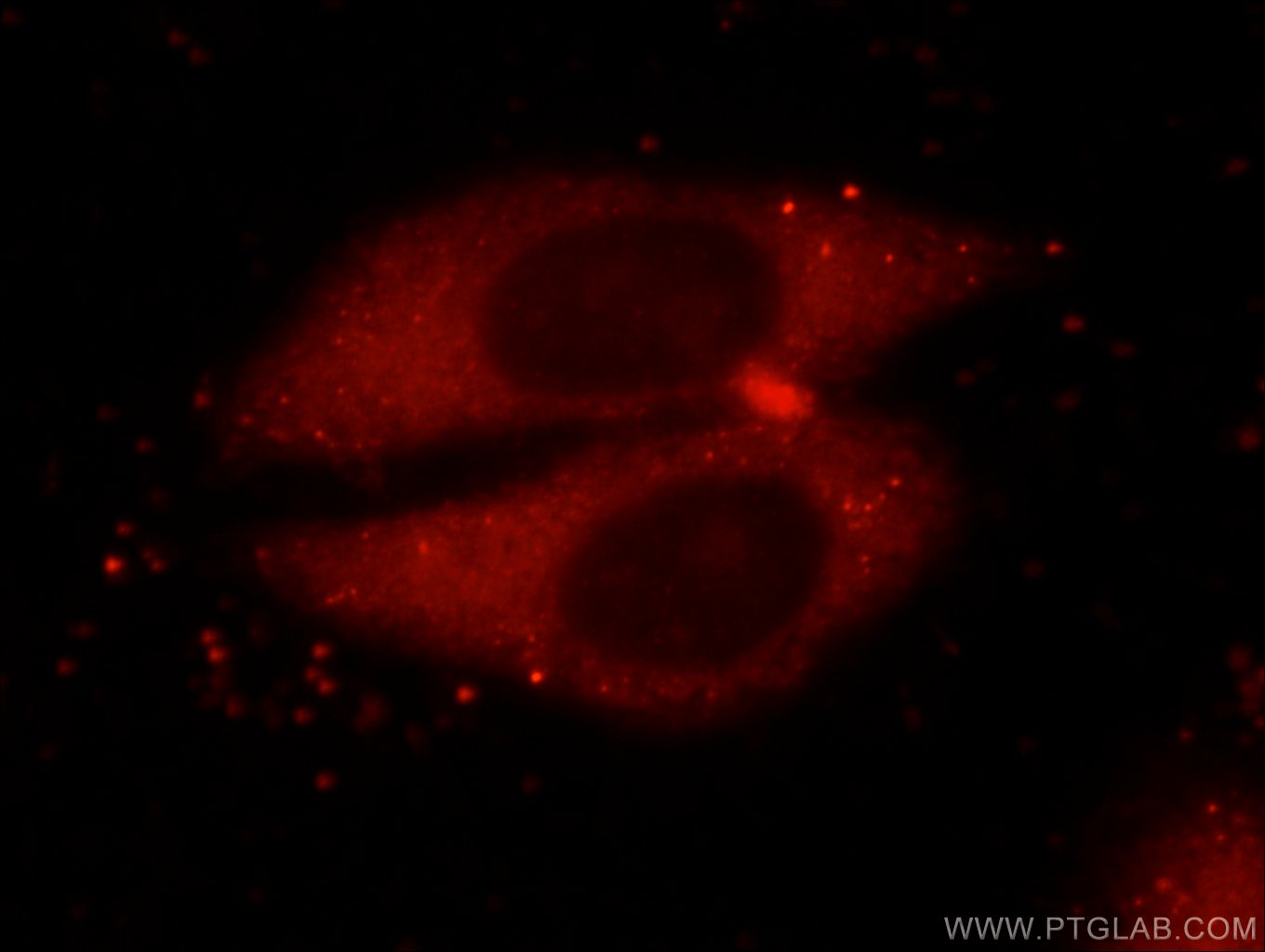 PRDX1 Polyclonal antibody