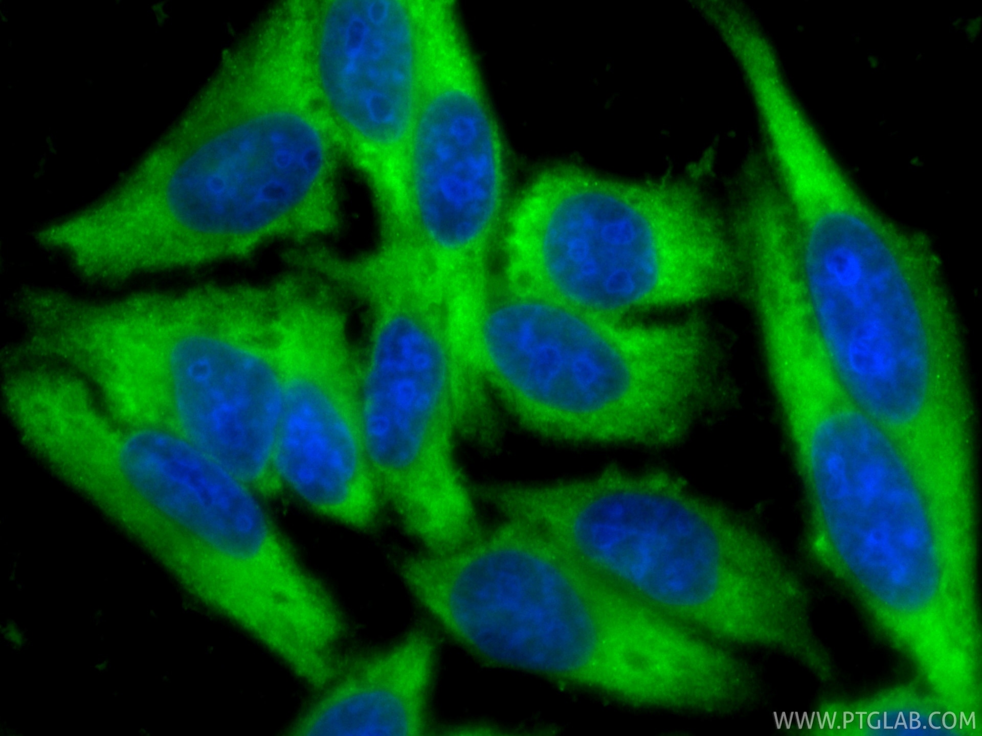 Immunofluorescence (IF) / fluorescent staining of HepG2 cells using PRDX1 Polyclonal antibody (15816-1-AP)