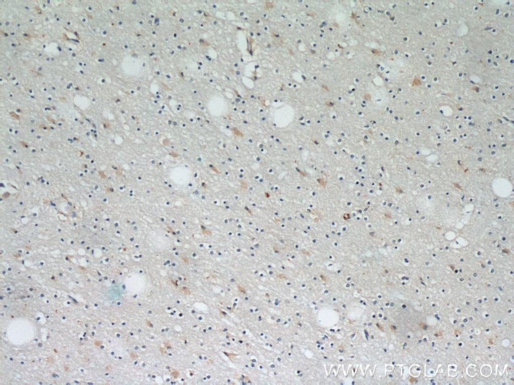 Immunohistochemistry (IHC) staining of human brain tissue using PRDX1 Polyclonal antibody (15816-1-AP)