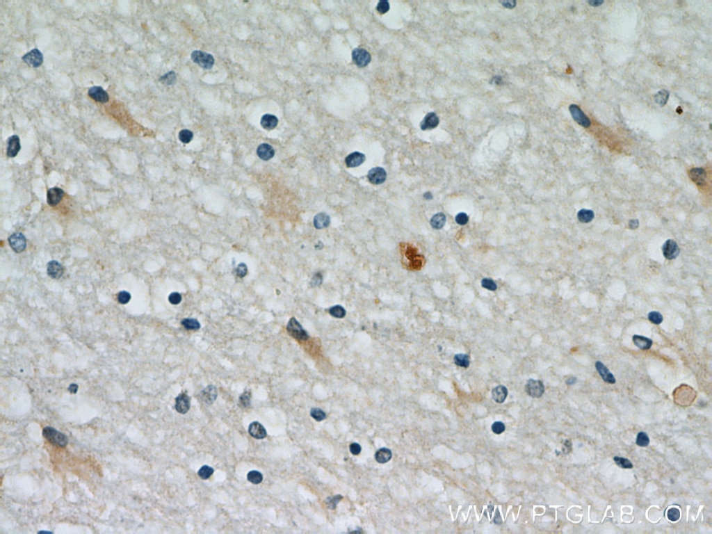 Immunohistochemistry (IHC) staining of human brain tissue using PRDX1 Polyclonal antibody (15816-1-AP)