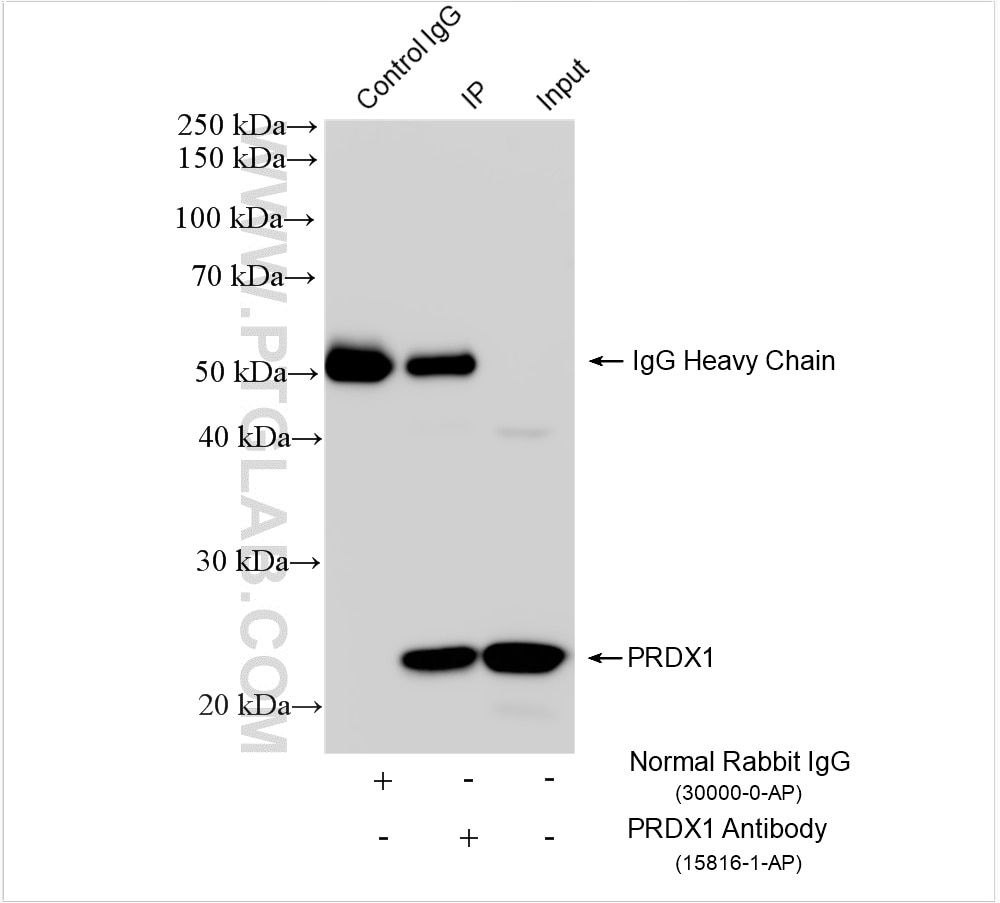 Immunoprecipitation (IP) experiment of HEK-293 cells using PRDX1 Polyclonal antibody (15816-1-AP)