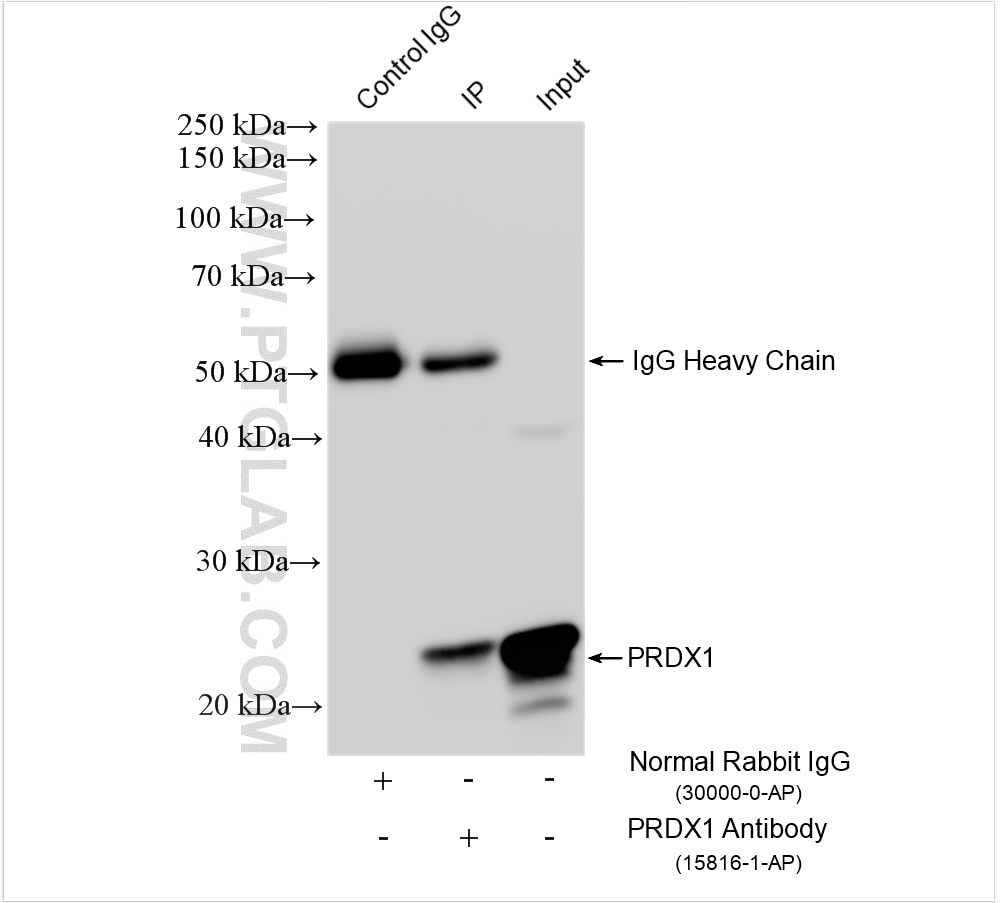 Immunoprecipitation (IP) experiment of mouse kidney tissue using PRDX1 Polyclonal antibody (15816-1-AP)