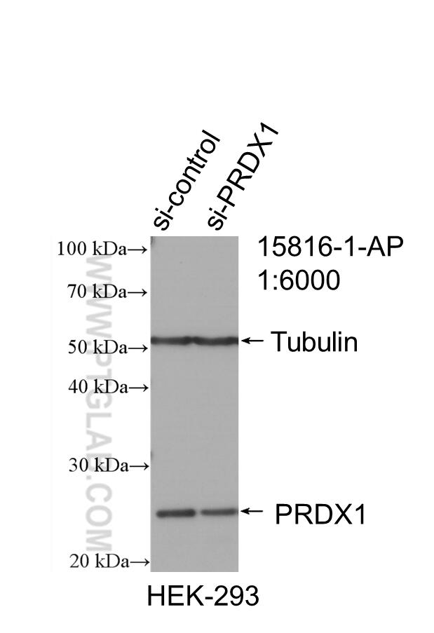 Western Blot (WB) analysis of HEK-293 cells using PRDX1 Polyclonal antibody (15816-1-AP)