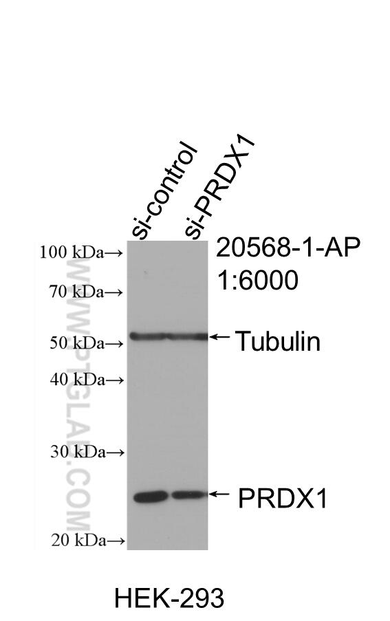 Western Blot (WB) analysis of HEK-293 cells using PRDX1 Polyclonal antibody (20568-1-AP)