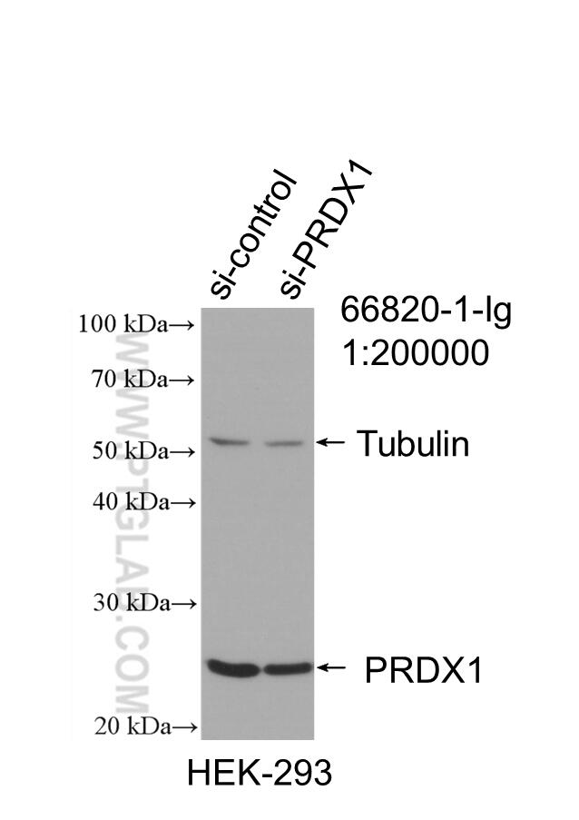 Western Blot (WB) analysis of HEK-293 cells using PRDX1 Monoclonal antibody (66820-1-Ig)