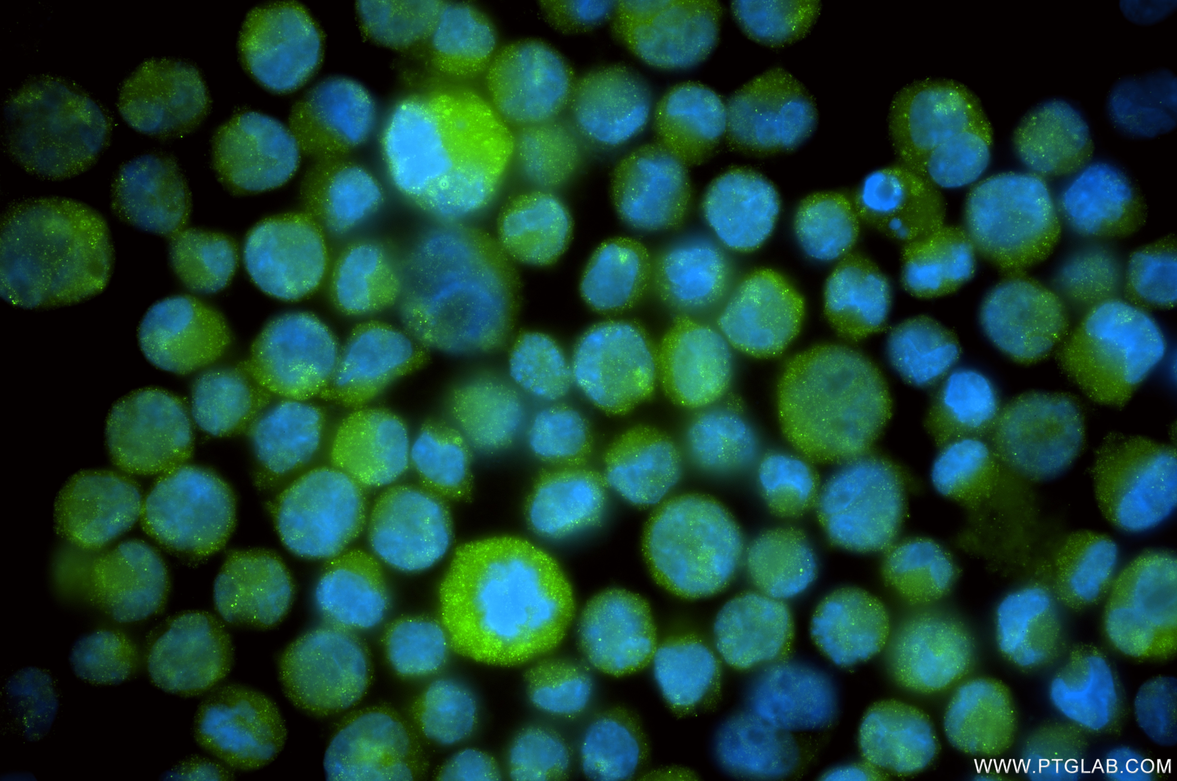 Immunofluorescence (IF) / fluorescent staining of K-562 cells using PRDX1 Recombinant monoclonal antibody (86589-1-RR)