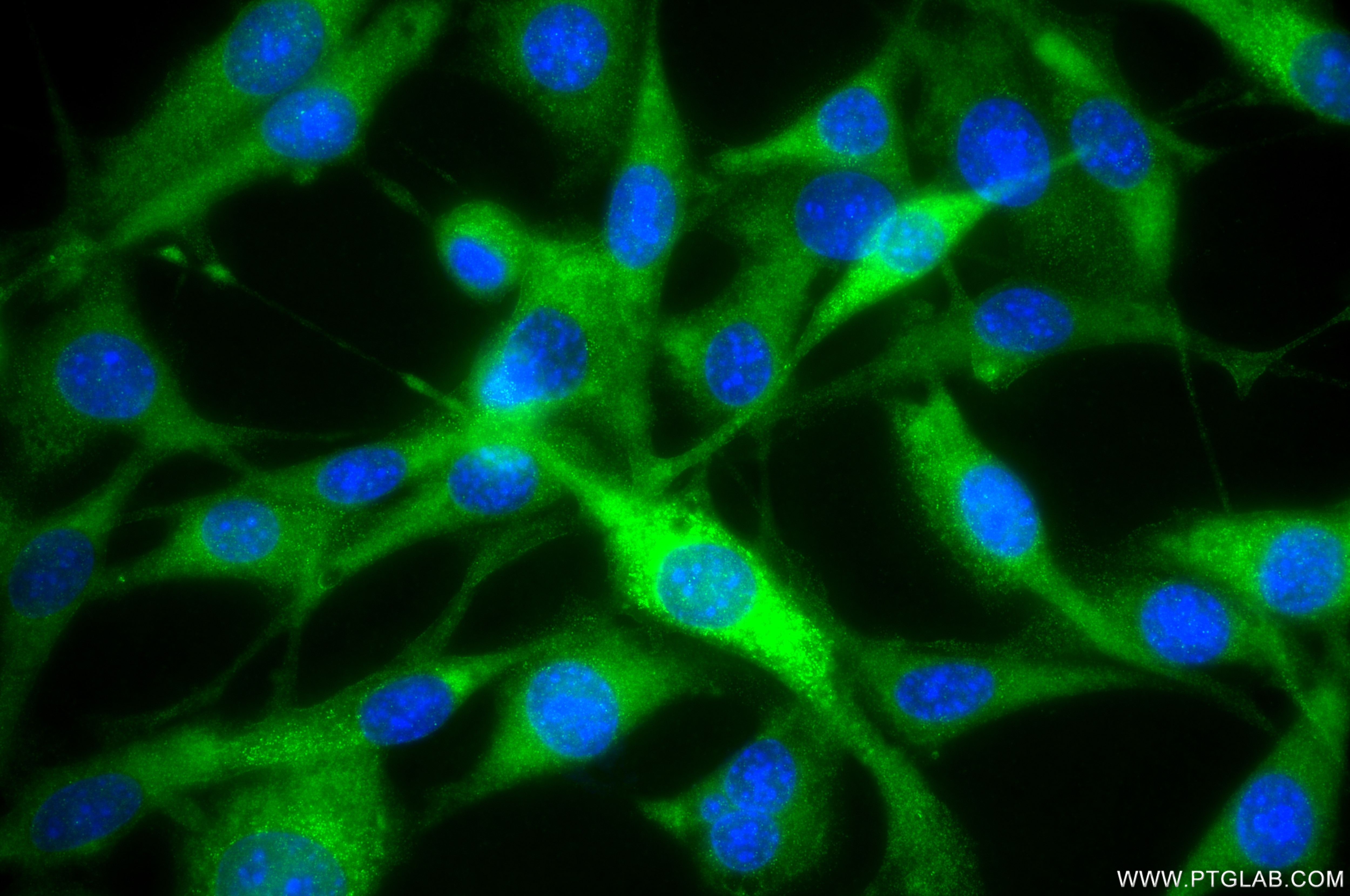 Immunofluorescence (IF) / fluorescent staining of NIH/3T3 cells using PRDX1 Recombinant monoclonal antibody (86589-1-RR)