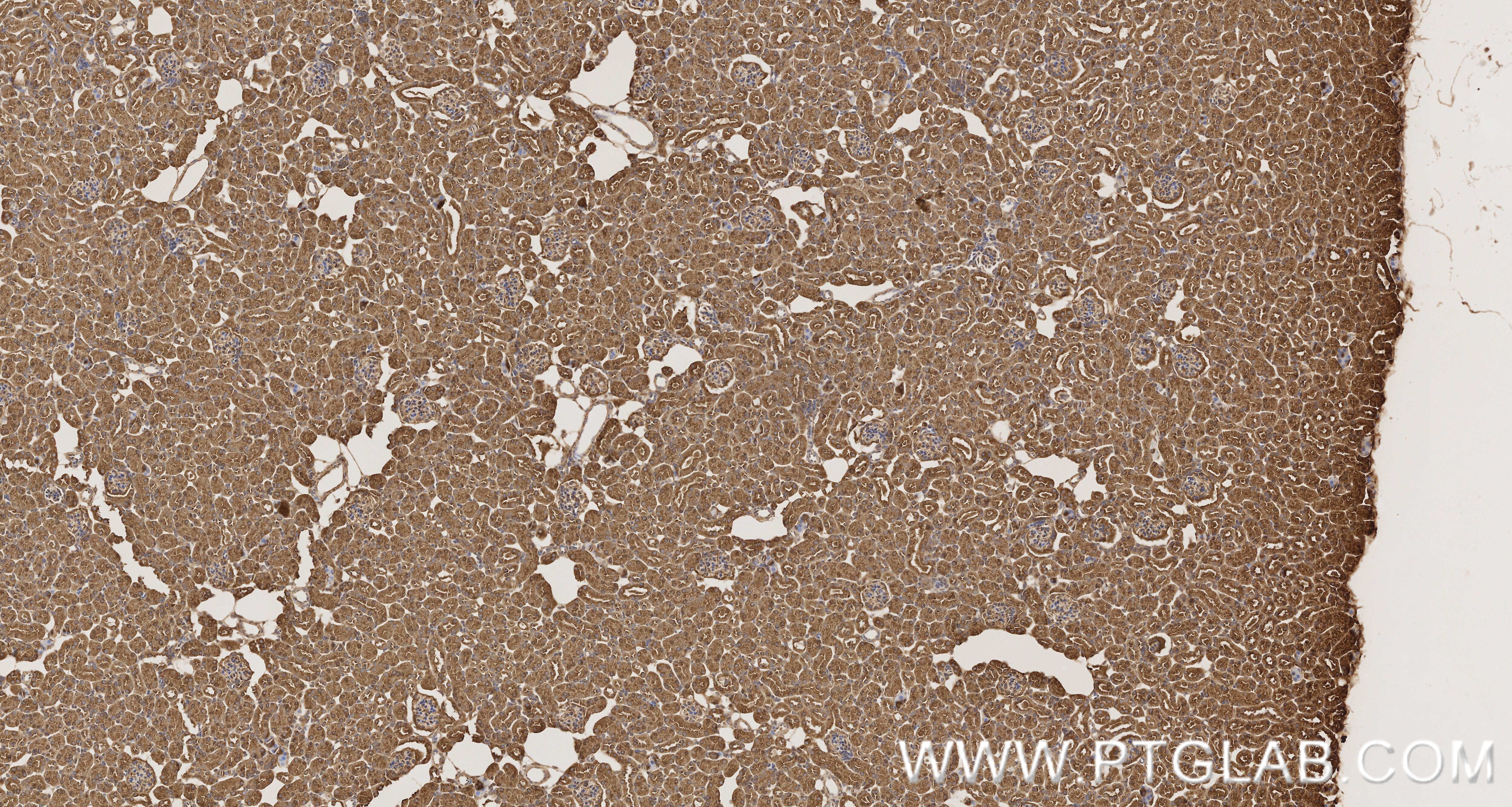 Immunohistochemistry (IHC) staining of mouse kidney tissue using PRDX1 Recombinant monoclonal antibody (86589-1-RR)