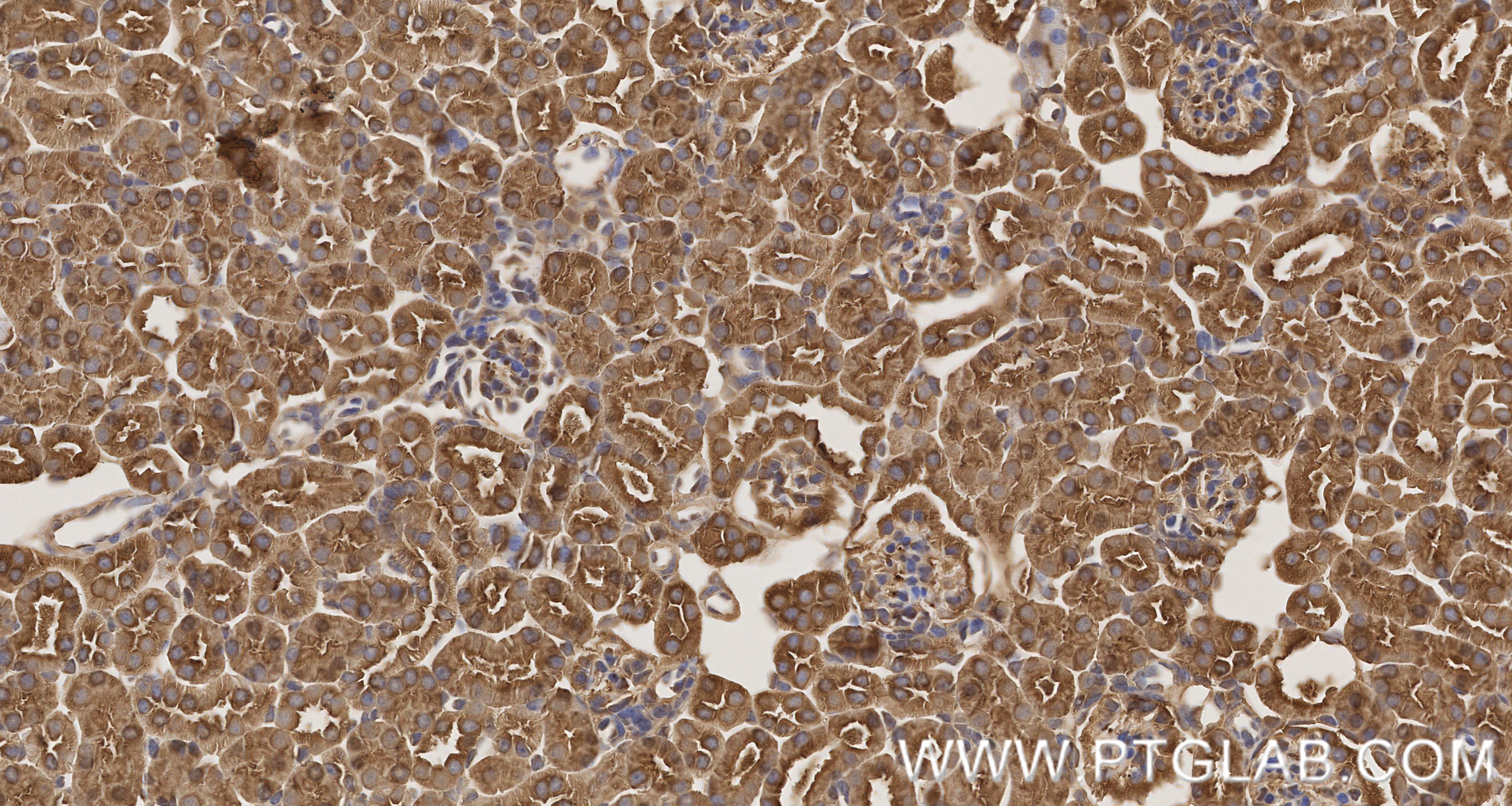 Immunohistochemistry (IHC) staining of mouse kidney tissue using PRDX1 Recombinant monoclonal antibody (86589-1-RR)