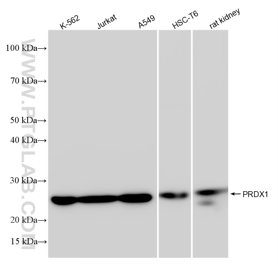 Western Blot (WB) analysis of various lysates using PRDX1 Recombinant antibody (86589-2-RR)