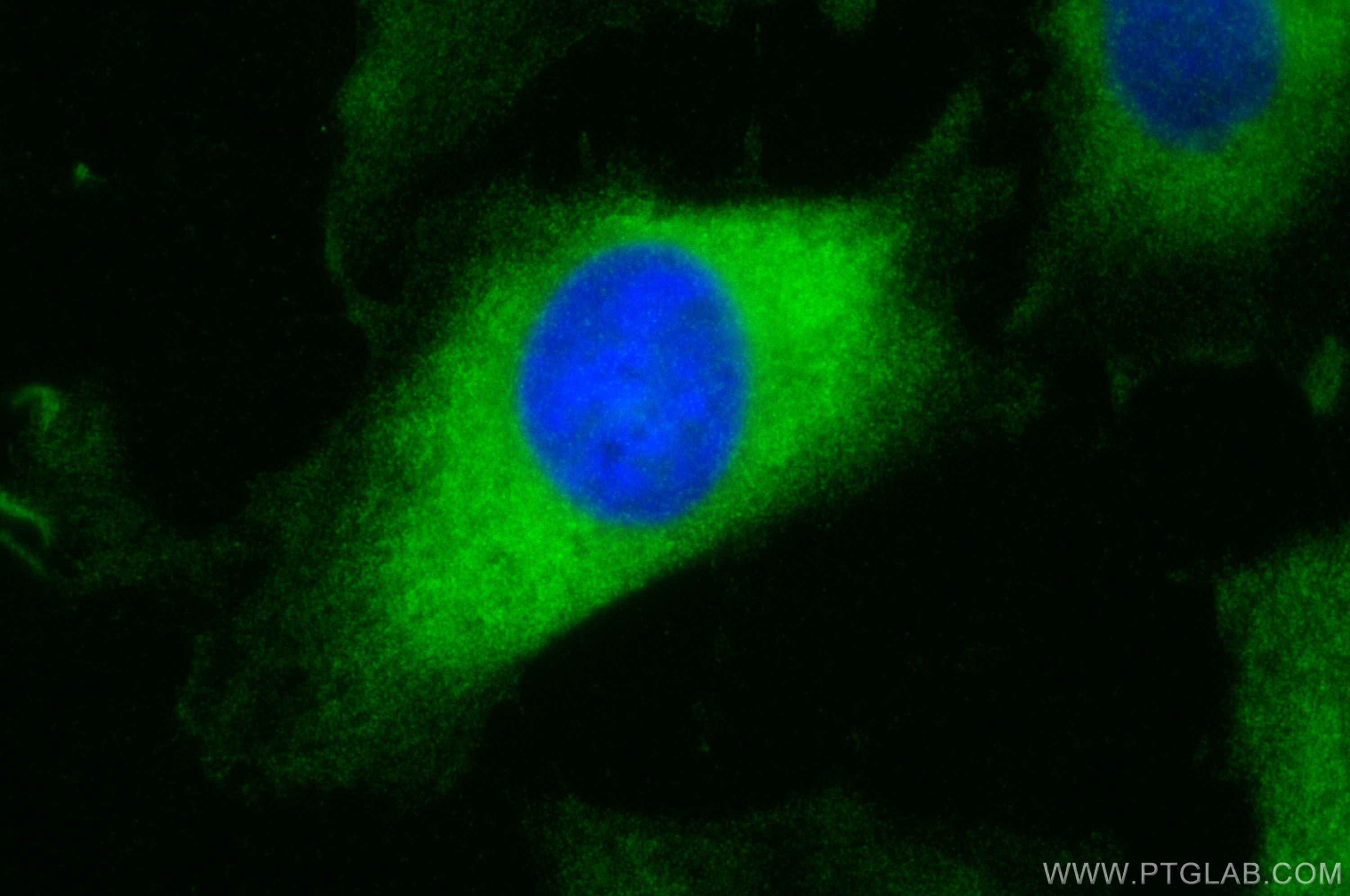Immunofluorescence (IF) / fluorescent staining of HeLa cells using peroxiredoxin 2 Polyclonal antibody (10545-2-AP)