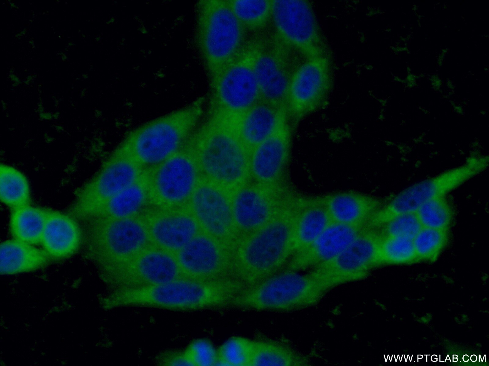 Immunofluorescence (IF) / fluorescent staining of HeLa cells using peroxiredoxin 2 Polyclonal antibody (10545-2-AP)