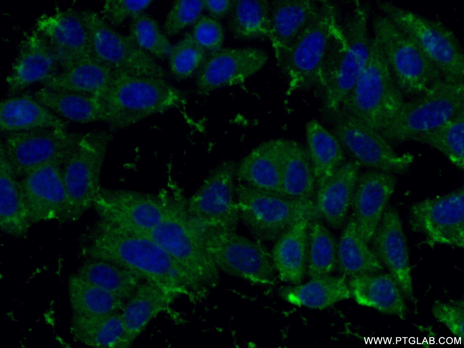 peroxiredoxin 2 Polyclonal antibody