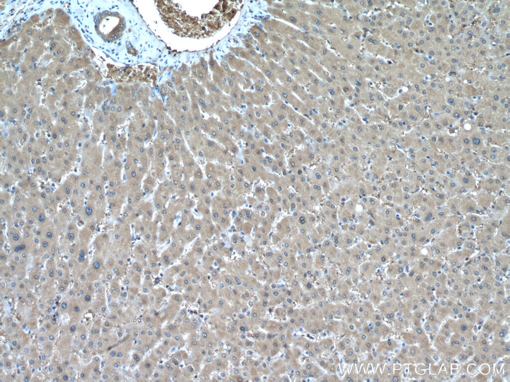 Immunohistochemistry (IHC) staining of human liver tissue using peroxiredoxin 2 Polyclonal antibody (10545-2-AP)