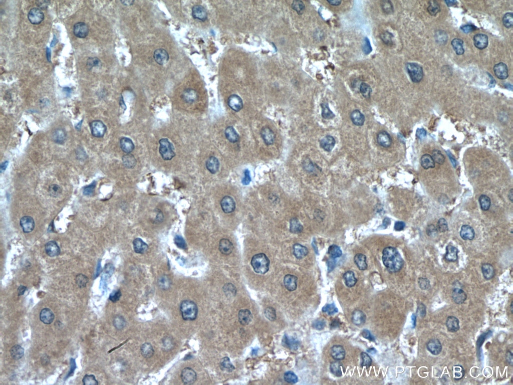 Immunohistochemistry (IHC) staining of human liver tissue using peroxiredoxin 2 Polyclonal antibody (10545-2-AP)
