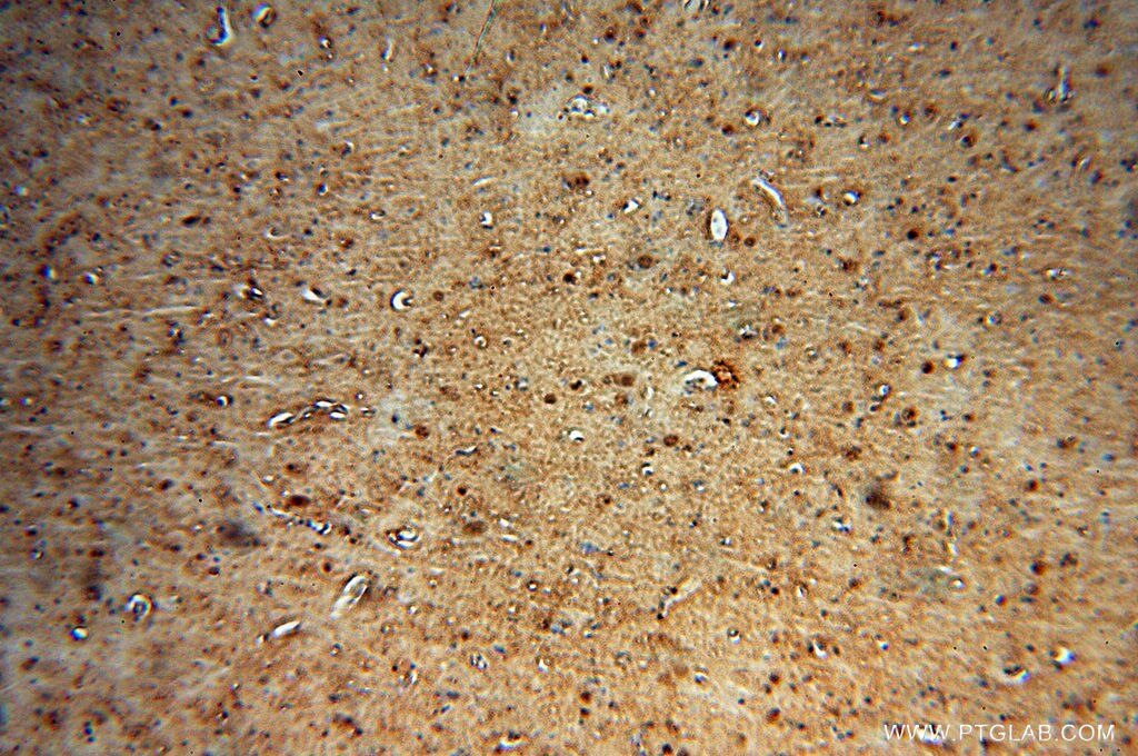 peroxiredoxin 2