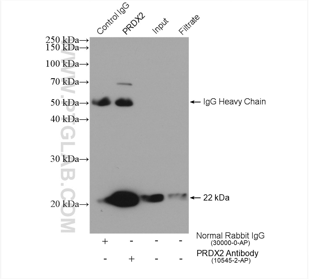 IP experiment of HepG2 using 10545-2-AP