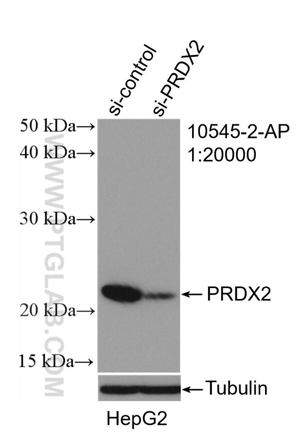 Western Blot (WB) analysis of HepG2 cells using peroxiredoxin 2 Polyclonal antibody (10545-2-AP)