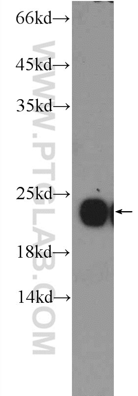 peroxiredoxin 2 Polyclonal antibody