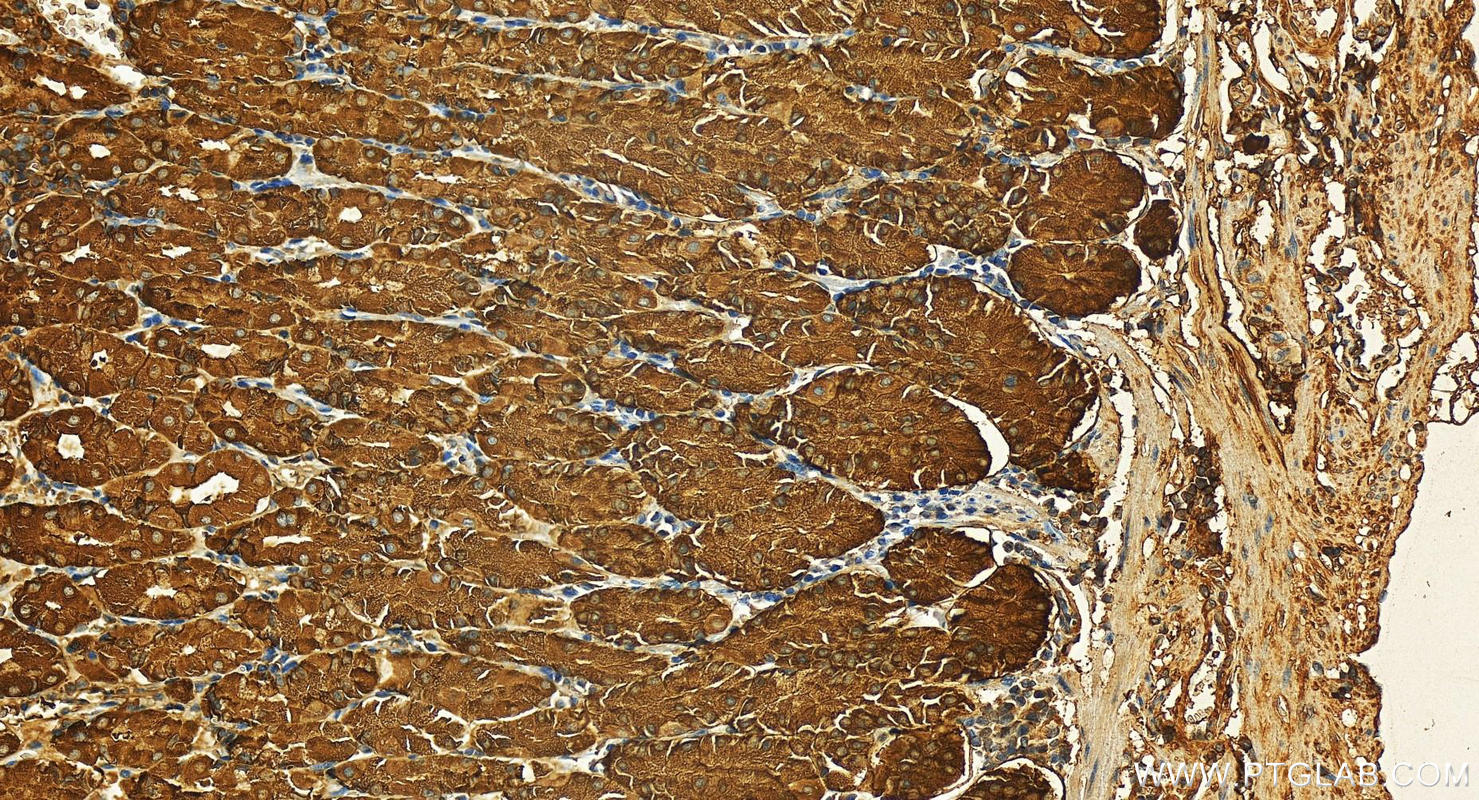 Immunohistochemistry (IHC) staining of human stomach tissue using Peroxiredoxin 2 Polyclonal antibody (20569-1-AP)