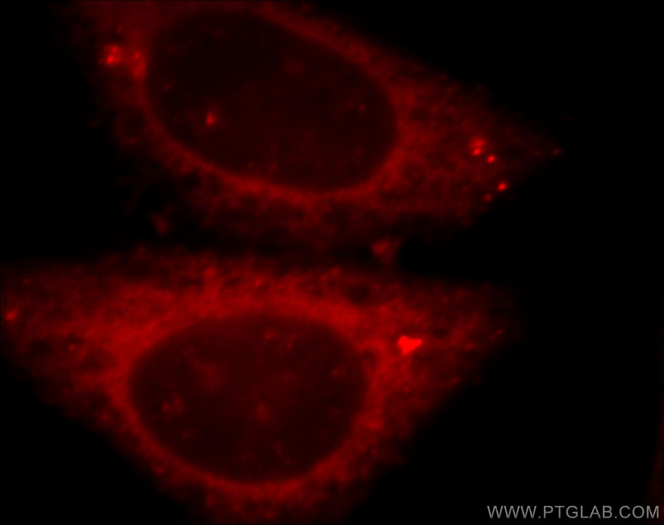 Immunofluorescence (IF) / fluorescent staining of HepG2 cells using peroxiredoxin 2 Polyclonal antibody (20569-1-AP)