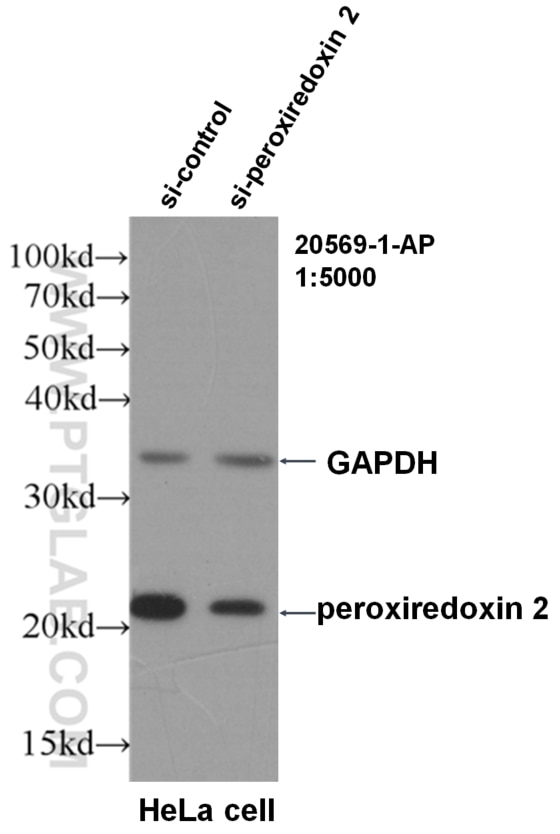 Western Blot (WB) analysis of HeLa cells using peroxiredoxin 2 Polyclonal antibody (20569-1-AP)