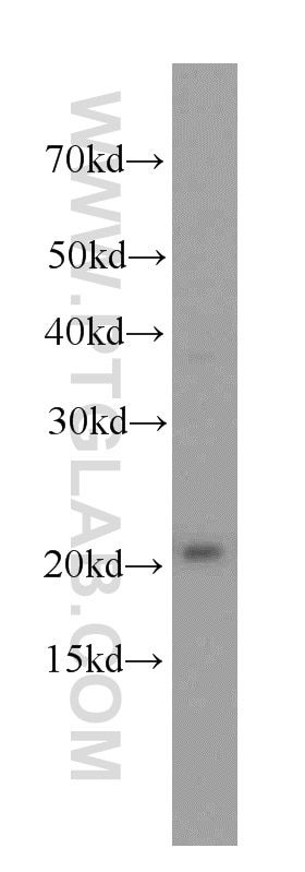 Western Blot (WB) analysis of HeLa cells using peroxiredoxin 2 Polyclonal antibody (20569-1-AP)