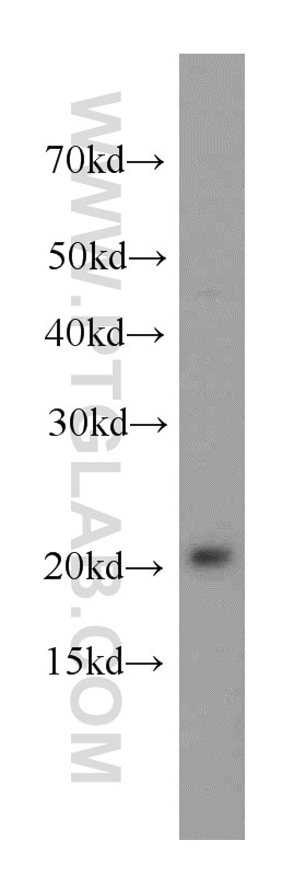 Western Blot (WB) analysis of HeLa cells using peroxiredoxin 2 Polyclonal antibody (20569-1-AP)