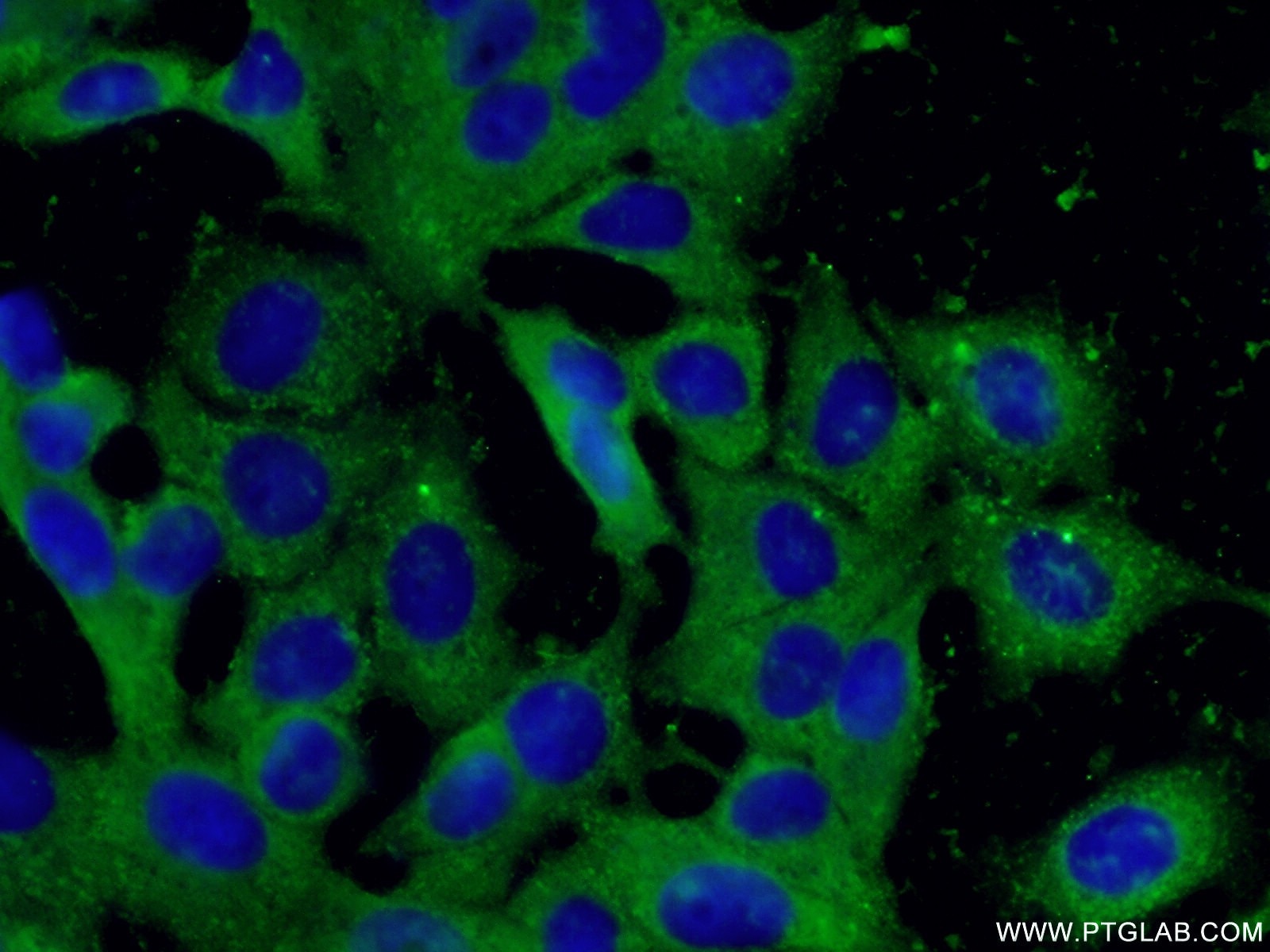 Immunofluorescence (IF) / fluorescent staining of MCF-7 cells using peroxiredoxin 2 Monoclonal antibody (60202-1-Ig)