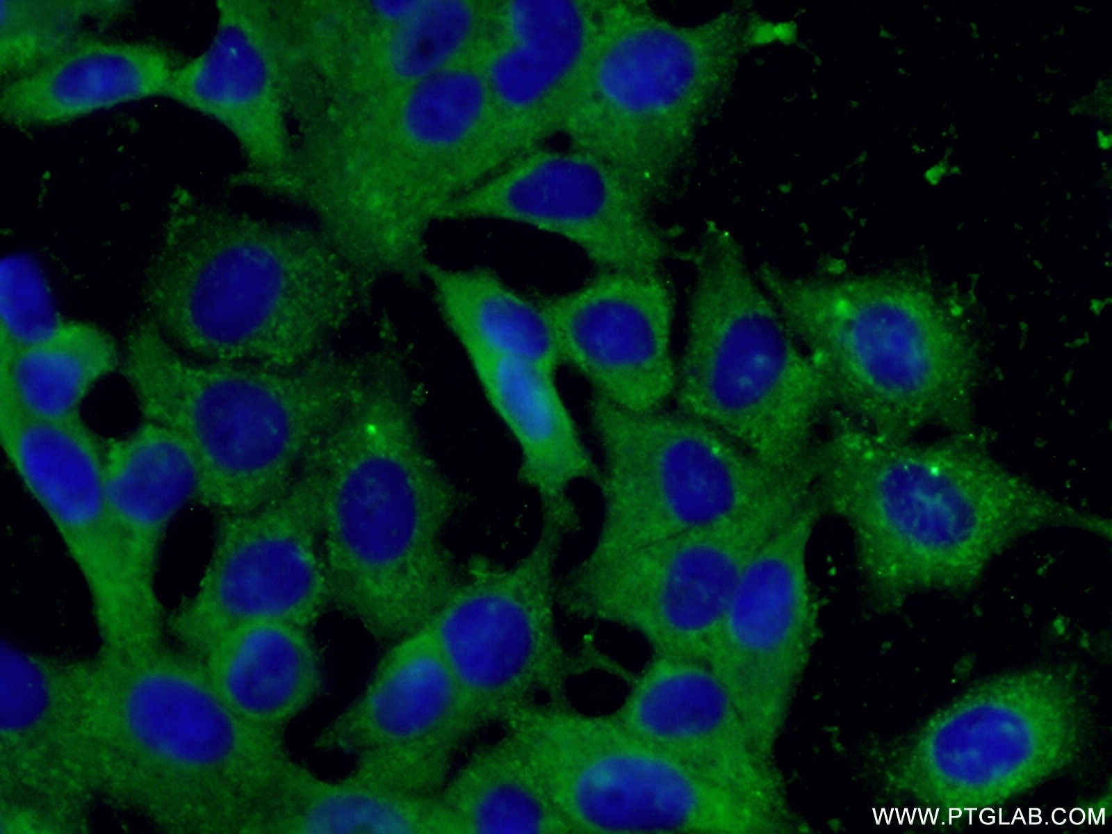 peroxiredoxin 2