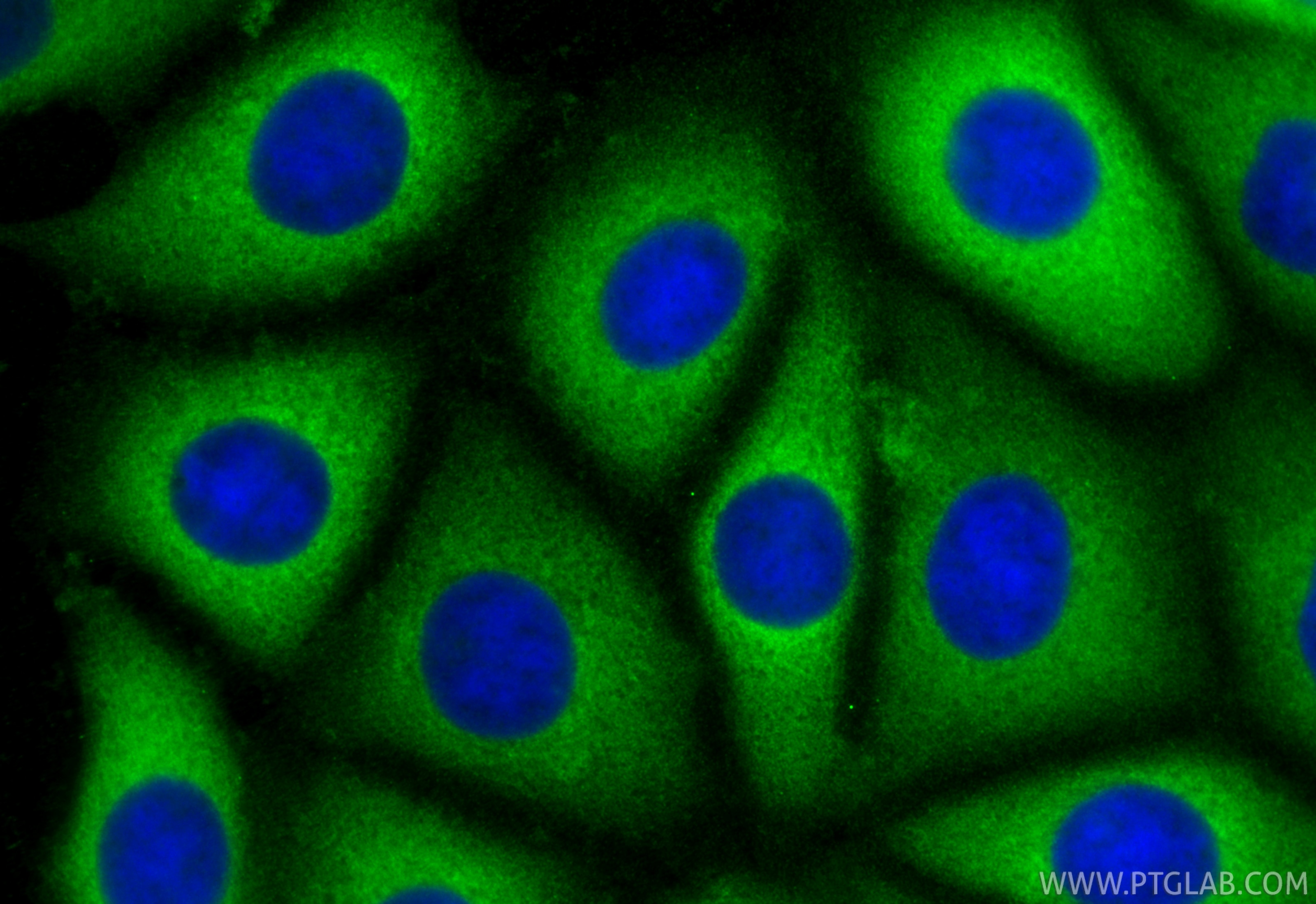 IF Staining of MCF-7 using 60202-1-Ig Immunofluorescence (IF) / fluorescent staining of MCF-7 cells using Peroxiredoxin 2 Monoclonal antibody (60202-1-Ig)
