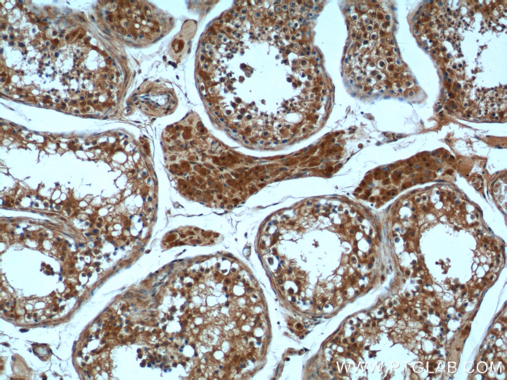 Immunohistochemistry (IHC) staining of human testis tissue using peroxiredoxin 2 Monoclonal antibody (60202-1-Ig)