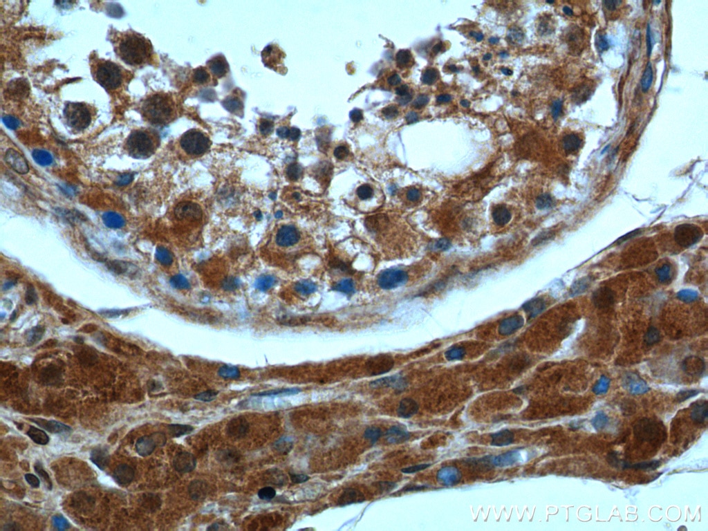 Immunohistochemistry (IHC) staining of human testis tissue using peroxiredoxin 2 Monoclonal antibody (60202-1-Ig)