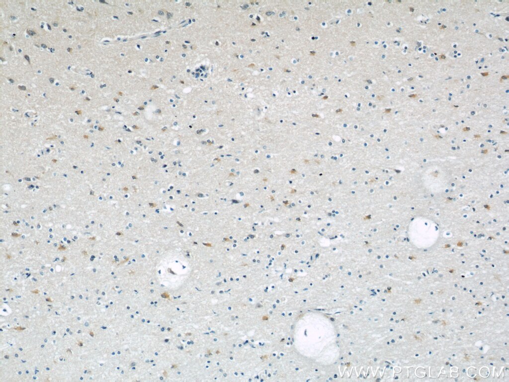 Immunohistochemistry (IHC) staining of human brain tissue using peroxiredoxin 2 Monoclonal antibody (60202-1-Ig)