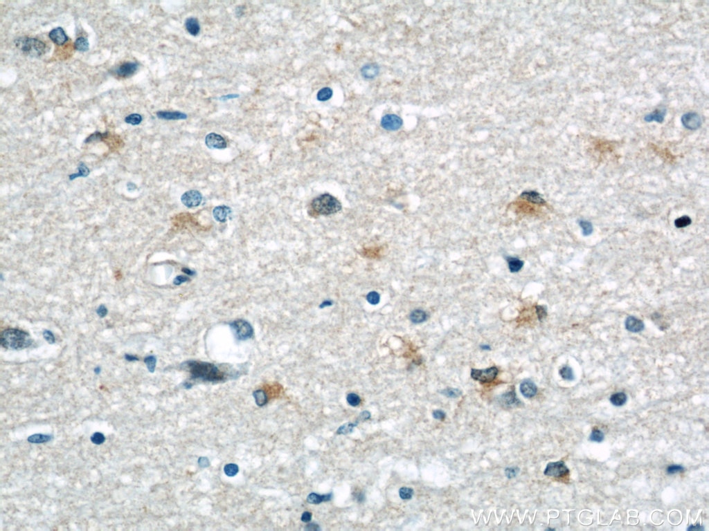 Immunohistochemistry (IHC) staining of human brain tissue using peroxiredoxin 2 Monoclonal antibody (60202-1-Ig)