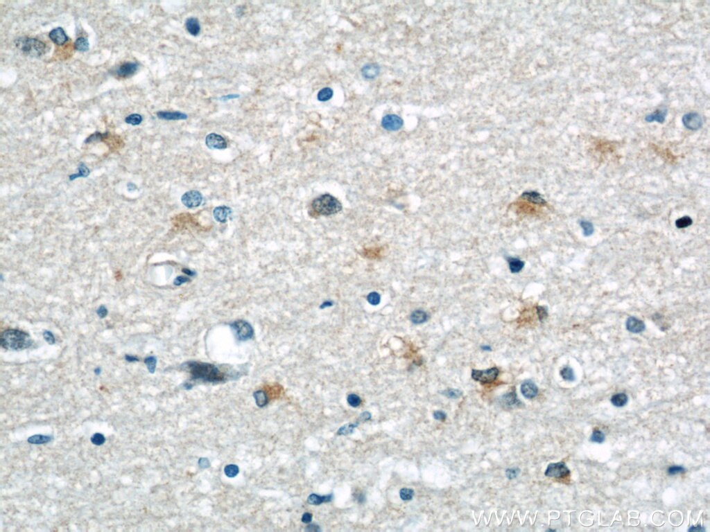 IHC staining of human brain using 60202-1-Ig