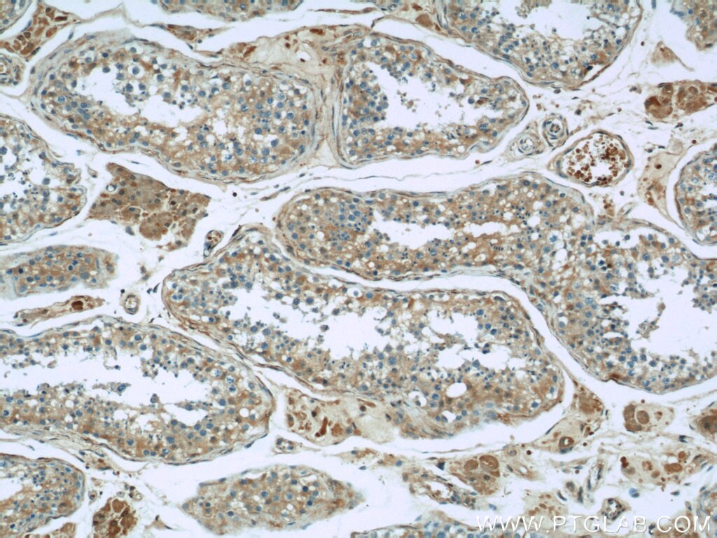 Immunohistochemistry (IHC) staining of human testis tissue using peroxiredoxin 2 Monoclonal antibody (60202-1-Ig)