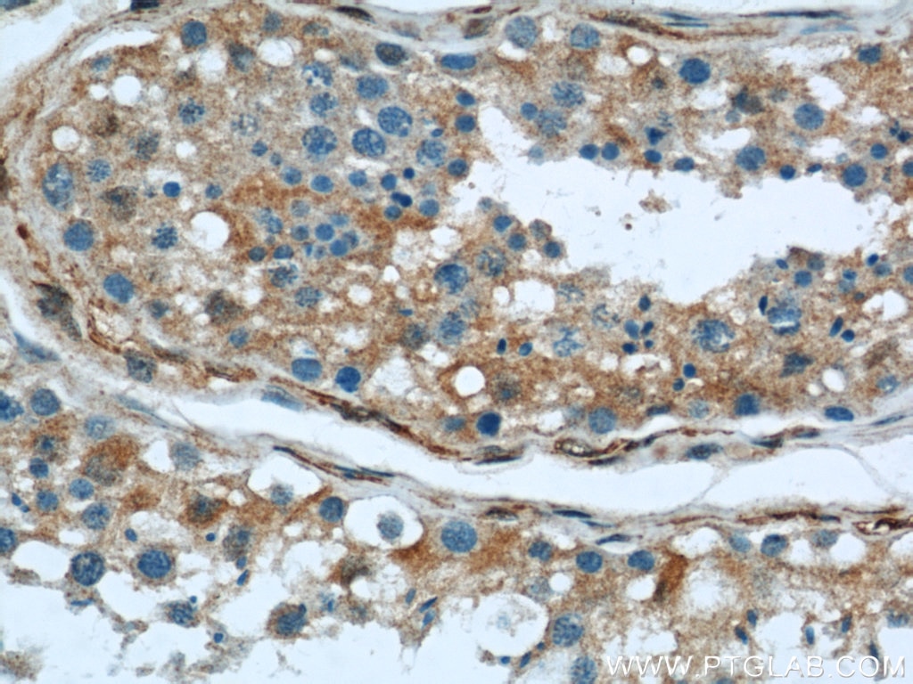 Immunohistochemistry (IHC) staining of human testis tissue using peroxiredoxin 2 Monoclonal antibody (60202-1-Ig)