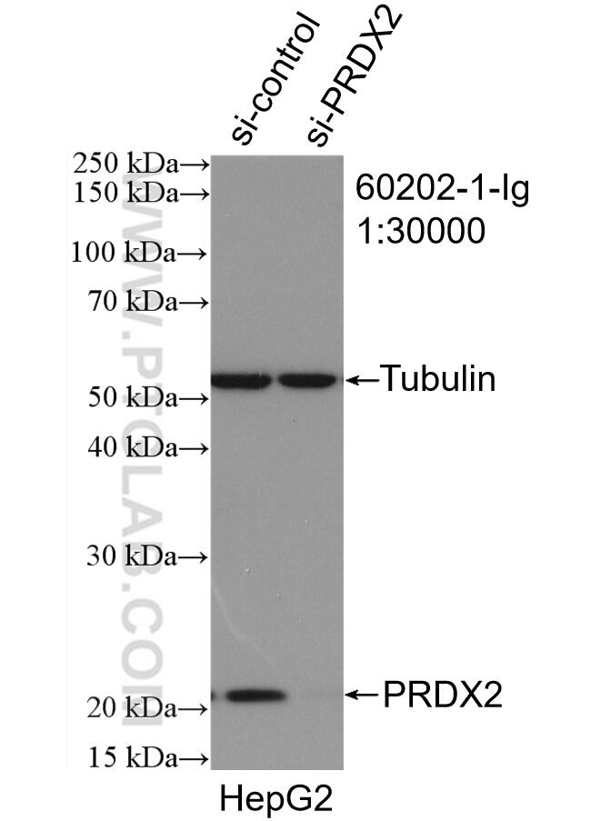 Western Blot (WB) analysis of HepG2 cells using peroxiredoxin 2 Monoclonal antibody (60202-1-Ig)