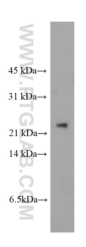 Western Blot (WB) analysis of MCF-7 cells using peroxiredoxin 2 Monoclonal antibody (60202-1-Ig)