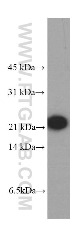 Western Blot (WB) analysis of human testis tissue using peroxiredoxin 2 Monoclonal antibody (60202-1-Ig)