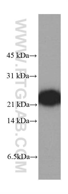 Western Blot (WB) analysis of fetal human brain tissue using peroxiredoxin 2 Monoclonal antibody (60202-1-Ig)